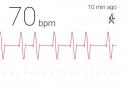 Cardiograph screenshot 2