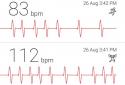 Cardiograph screenshot 3
